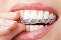 Invisalign Dentist