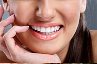 Teeth Whitening